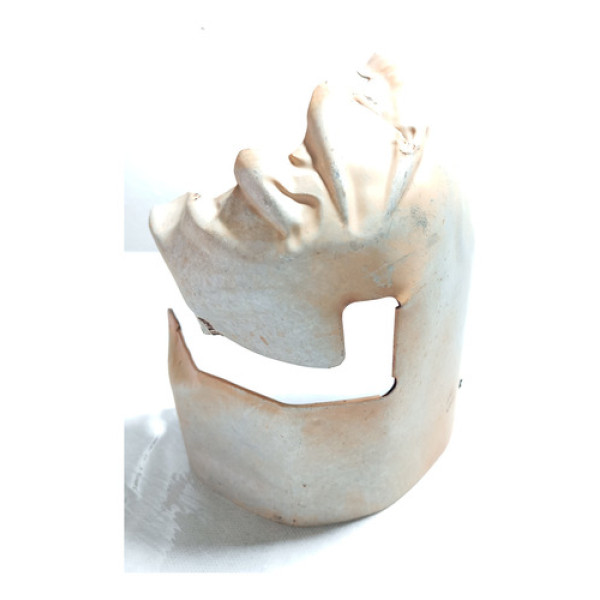 Protetor Escape Peugeot 307 1.6 2008 2009 2010 2011 2012